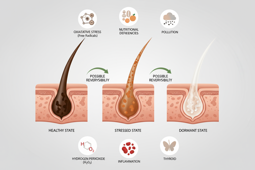 Anatomie follicule pileux montrant mélanocytes actifs, affaiblis et dormants expliquant formation cheveux blancs précoces et solutions naturelles de réversibilité