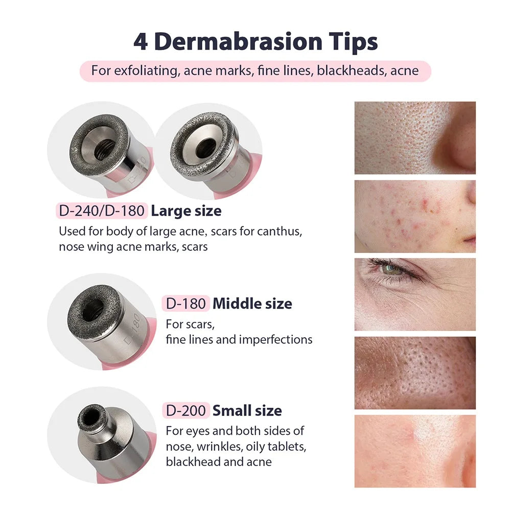 Appareil micro dermabrasion maison avec 4 embouts pour exfolier les cicatrices d'acné et les imperfections