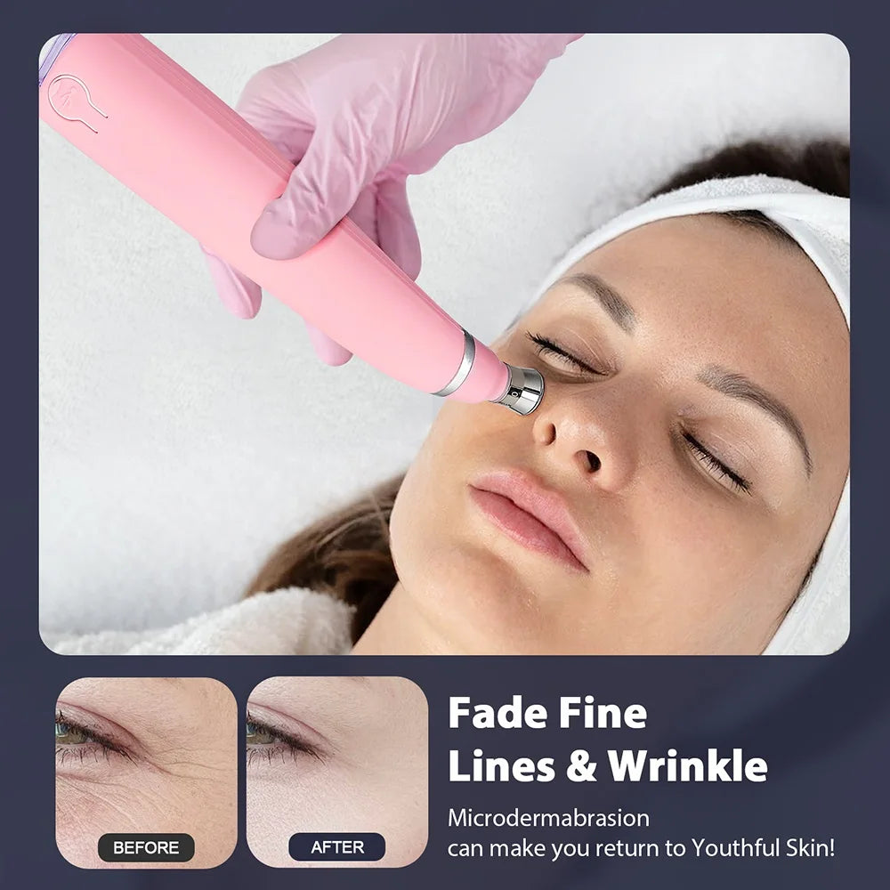 Appareil micro dermabrasion maison utilisé pour réduire les ridules et revitaliser la peau