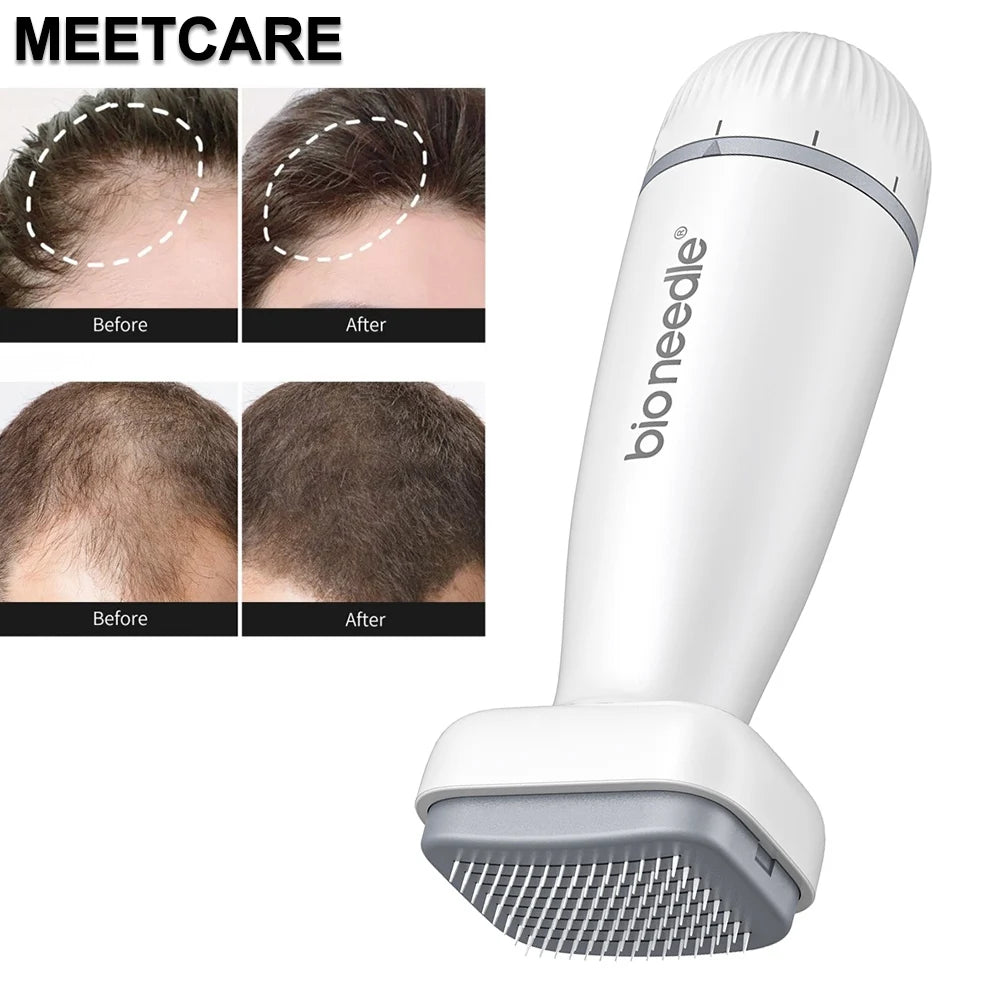 Appareil de microneedling 120 aiguilles avec résultats avant et après pour la régénération capillaire