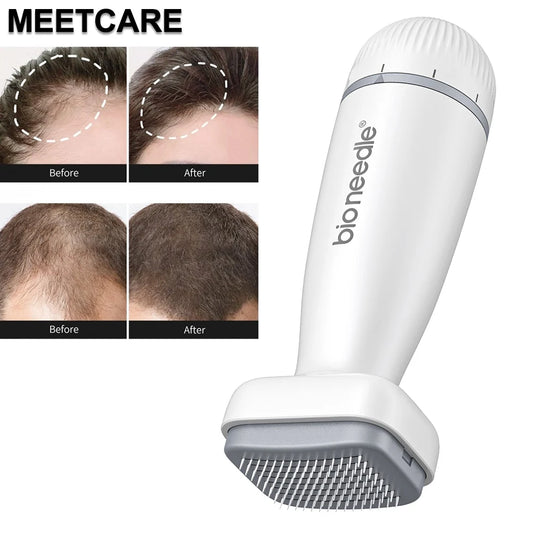 Appareil de microneedling 120 aiguilles avec résultats avant et après pour la régénération capillaire